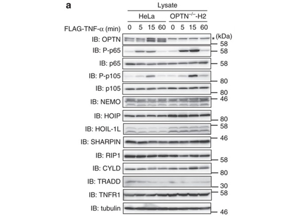 Western Blot using NFkB P-p65